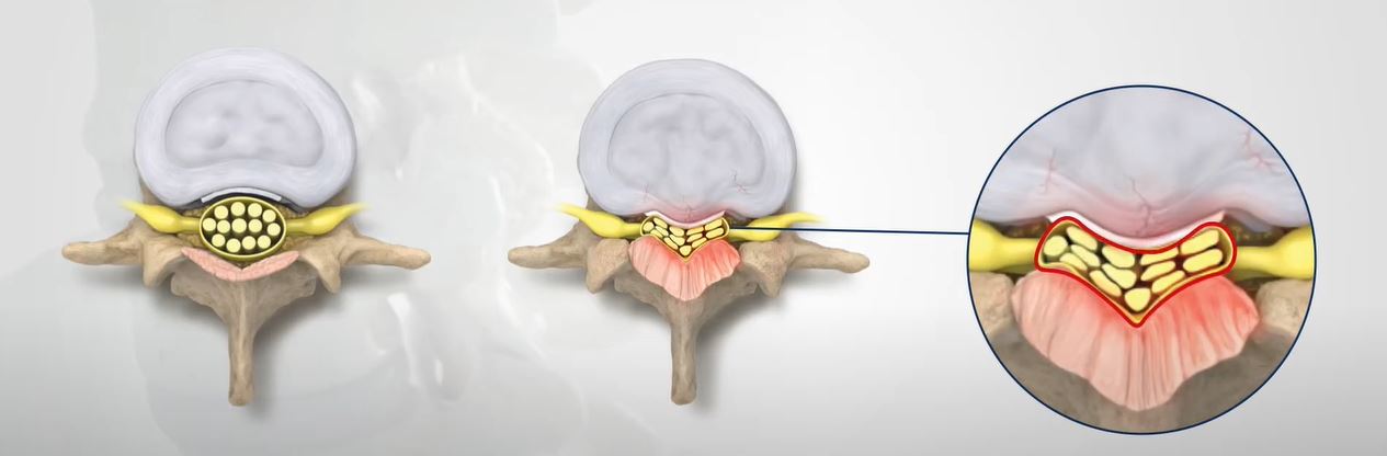 Interventional Pain Management, Pain Management Solutions, Chronic Pain Treatment, Nerve Pain Management, Spinal Cord Stimulator, Non-Surgical Pain Relief, Medial Branch Nerve Blocks, Joint Injections For Arthritis, Herniated Disc Treatment, Pain Relief For Muscle Strain, Pain Alleviation