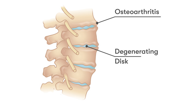 Interventional Pain Management, Pain Management Solutions, Chronic Pain Treatment, Nerve Pain Management, Spinal Cord Stimulator, Non-Surgical Pain Relief, Medial Branch Nerve Blocks, Joint Injections For Arthritis, Herniated Disc Treatment, Pain Relief For Muscle Strain, Pain Alleviation