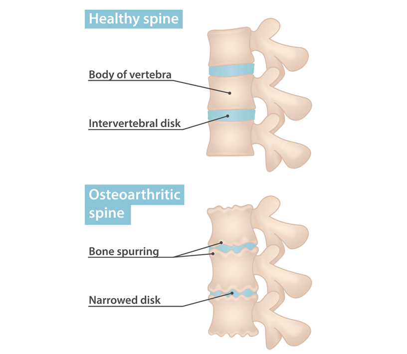 Interventional Pain Management, Pain Management Solutions, Chronic Pain Treatment, Nerve Pain Management, Spinal Cord Stimulator, Non-Surgical Pain Relief, Medial Branch Nerve Blocks, Joint Injections For Arthritis, Herniated Disc Treatment, Pain Relief For Muscle Strain, Pain Alleviation