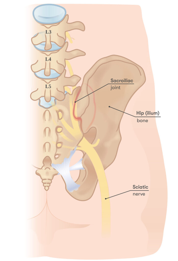 Interventional Pain Management, Pain Management Solutions, Chronic Pain Treatment, Nerve Pain Management, Spinal Cord Stimulator, Non-Surgical Pain Relief, Medial Branch Nerve Blocks, Joint Injections For Arthritis, Herniated Disc Treatment, Pain Relief For Muscle Strain, Pain Alleviation