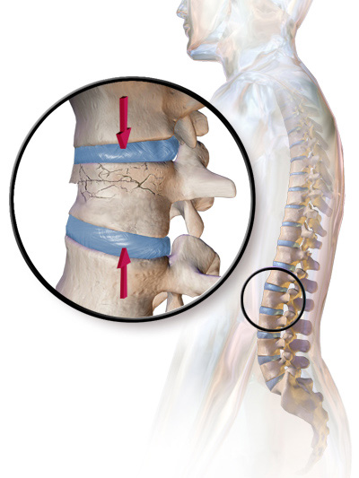 Interventional Pain Management, Pain Management Solutions, Chronic Pain Treatment, Nerve Pain Management, Spinal Cord Stimulator, Non-Surgical Pain Relief, Medial Branch Nerve Blocks, Joint Injections For Arthritis, Herniated Disc Treatment, Pain Relief For Muscle Strain, Pain Alleviation