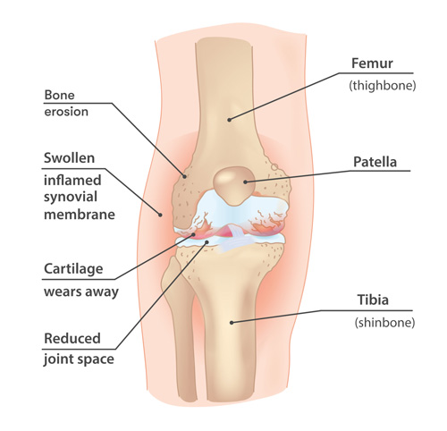 Interventional Pain Management, Pain Management Solutions, Chronic Pain Treatment, Nerve Pain Management, Spinal Cord Stimulator, Non-Surgical Pain Relief, Medial Branch Nerve Blocks, Joint Injections For Arthritis, Herniated Disc Treatment, Pain Relief For Muscle Strain, Pain Alleviation