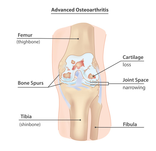 Interventional Pain Management, Pain Management Solutions, Chronic Pain Treatment, Nerve Pain Management, Spinal Cord Stimulator, Non-Surgical Pain Relief, Medial Branch Nerve Blocks, Joint Injections For Arthritis, Herniated Disc Treatment, Pain Relief For Muscle Strain, Pain Alleviation