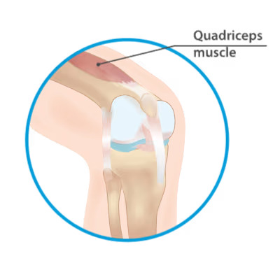 Interventional Pain Management, Pain Management Solutions, Chronic Pain Treatment, Nerve Pain Management, Spinal Cord Stimulator, Non-Surgical Pain Relief, Medial Branch Nerve Blocks, Joint Injections For Arthritis, Herniated Disc Treatment, Pain Relief For Muscle Strain, Pain Alleviation