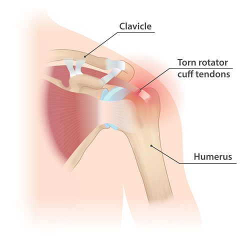 Interventional Pain Management, Pain Management Solutions, Chronic Pain Treatment, Nerve Pain Management, Spinal Cord Stimulator, Non-Surgical Pain Relief, Medial Branch Nerve Blocks, Joint Injections For Arthritis, Herniated Disc Treatment, Pain Relief For Muscle Strain, Pain Alleviation