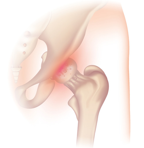Interventional Pain Management, Pain Management Solutions, Chronic Pain Treatment, Nerve Pain Management, Spinal Cord Stimulator, Non-Surgical Pain Relief, Medial Branch Nerve Blocks, Joint Injections For Arthritis, Herniated Disc Treatment, Pain Relief For Muscle Strain, Pain Alleviation