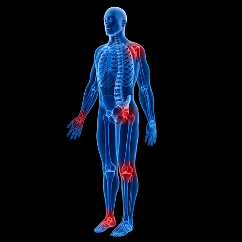 Interventional Pain Management, Pain Management Solutions, Chronic Pain Treatment, Nerve Pain Management, Spinal Cord Stimulator, Non-Surgical Pain Relief, Medial Branch Nerve Blocks, Joint Injections For Arthritis, Herniated Disc Treatment, Pain Relief For Muscle Strain, Pain Alleviation