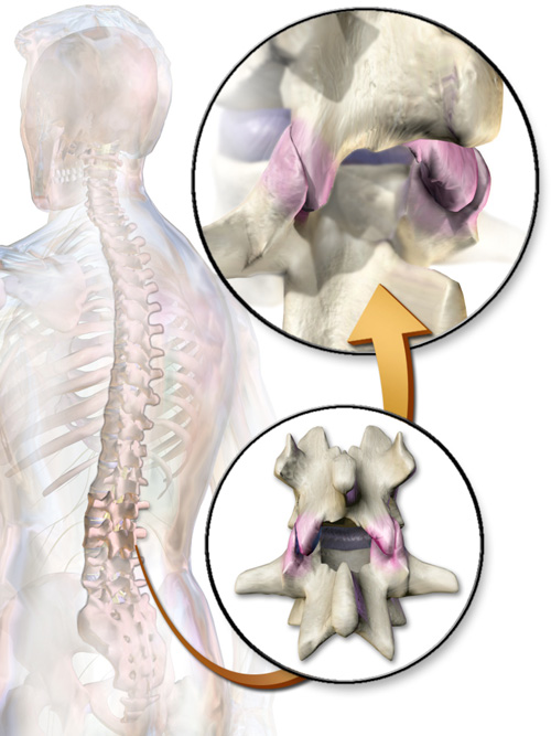 Interventional Pain Management, Pain Management Solutions, Chronic Pain Treatment, Nerve Pain Management, Spinal Cord Stimulator, Non-Surgical Pain Relief, Medial Branch Nerve Blocks, Joint Injections For Arthritis, Herniated Disc Treatment, Pain Relief For Muscle Strain, Pain Alleviation