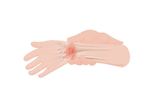 Interventional Pain Management, Pain Management Solutions, Chronic Pain Treatment, Nerve Pain Management, Spinal Cord Stimulator, Non-Surgical Pain Relief, Medial Branch Nerve Blocks, Joint Injections For Arthritis, Herniated Disc Treatment, Pain Relief For Muscle Strain, Pain Alleviation