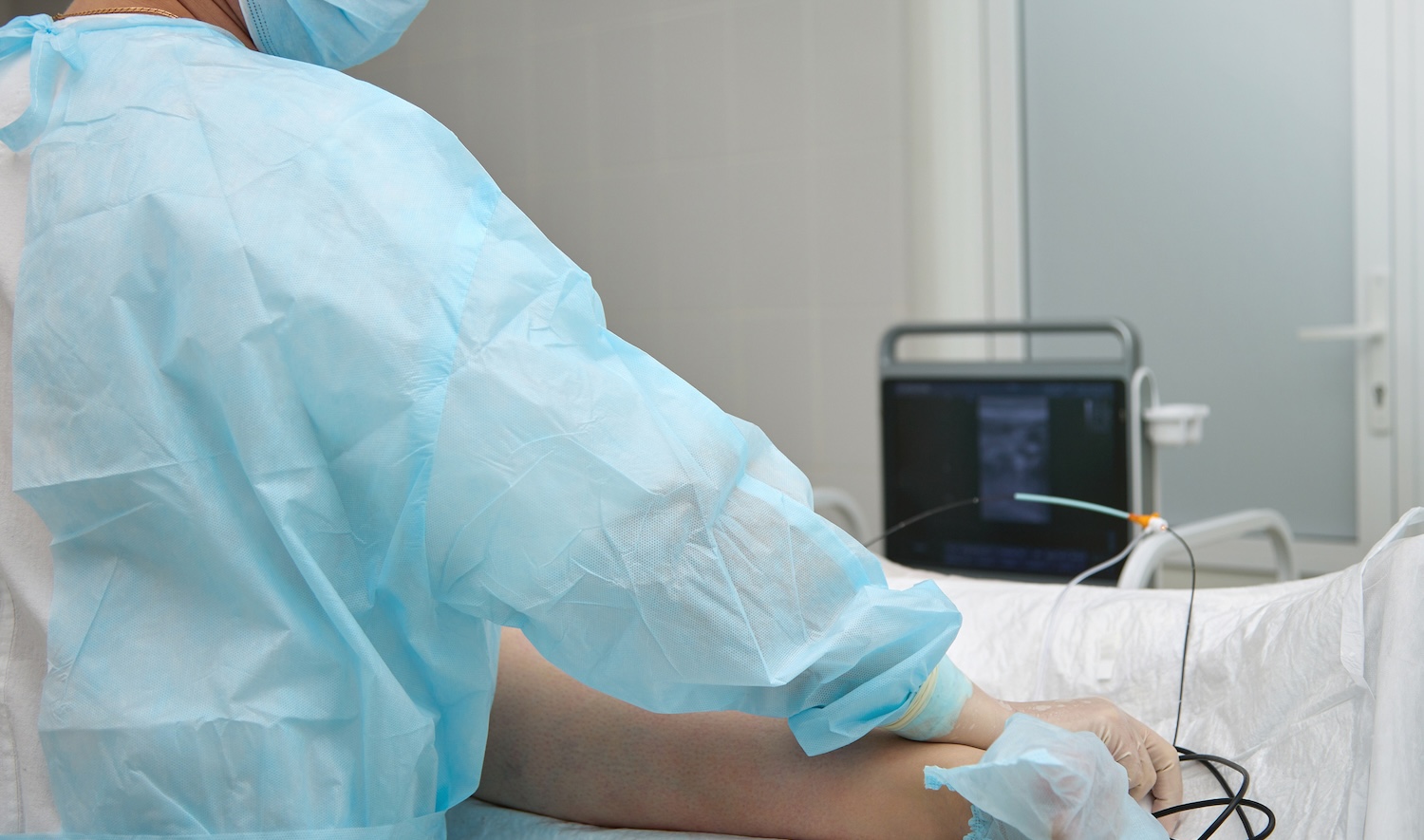 Radiofrequency Ablation